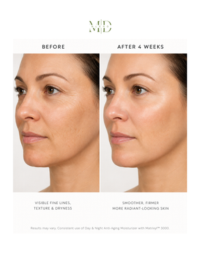 Anti-Aging Moisturizer with Matrixyl™ 3000